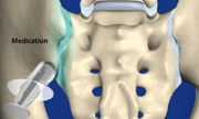 injection therapy for spine rhode island